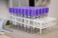 Медики приглашают начать осень с заботой о здоровье
